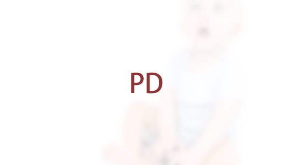 未成年人可以申请PD（检控裁量权）吗？