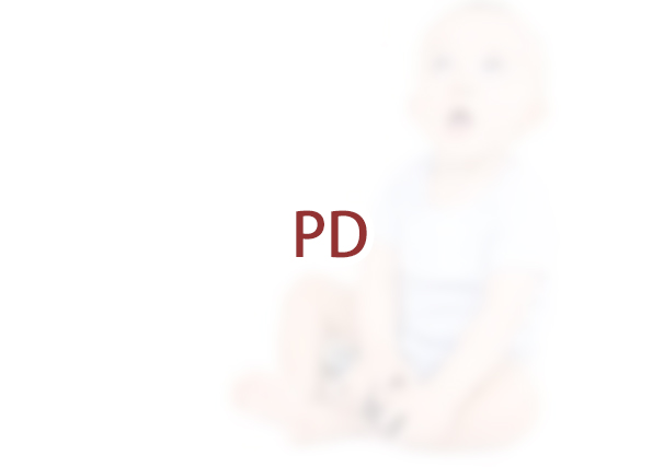 未成年人可以申请PD（检控裁量权）吗？